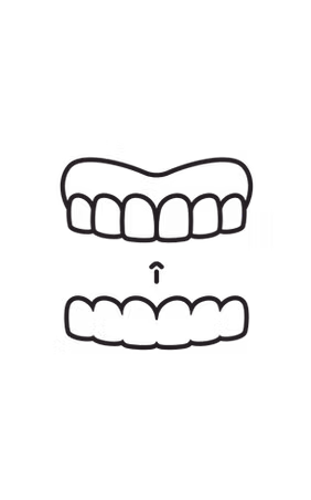 Invisalign illustration